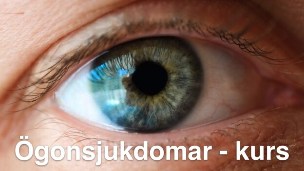 Ögonsjukdomar - kurs för allmänläkare