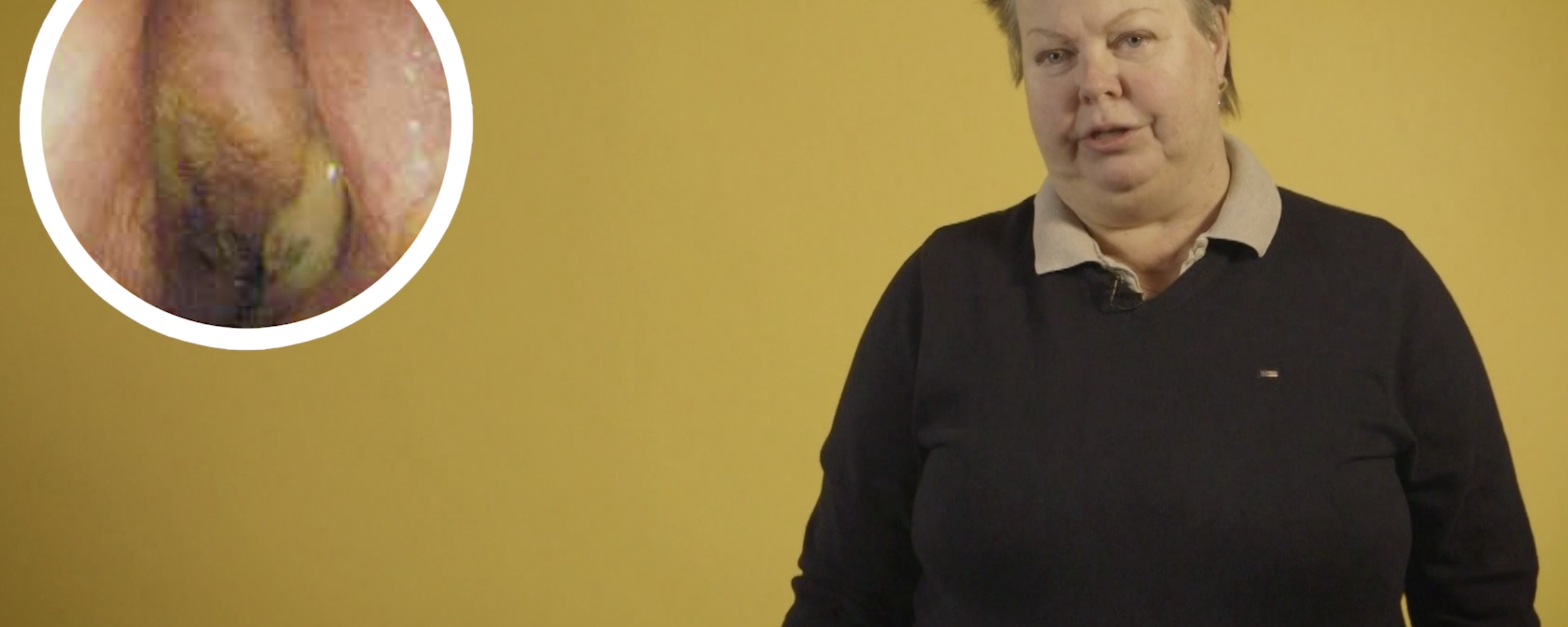Sinuit – film från Strama om utredning och behandling